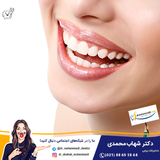 لمینت سرامیکی ایمکس چیست؟ - کلینیک دندانپزشکی دکتر شهاب محمدی